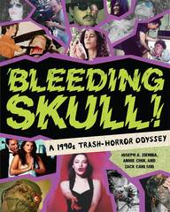 Bleeding Skull (STL104617)