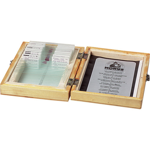 National 100xR DIN Achromat Objective Lens 1.25 N.A.