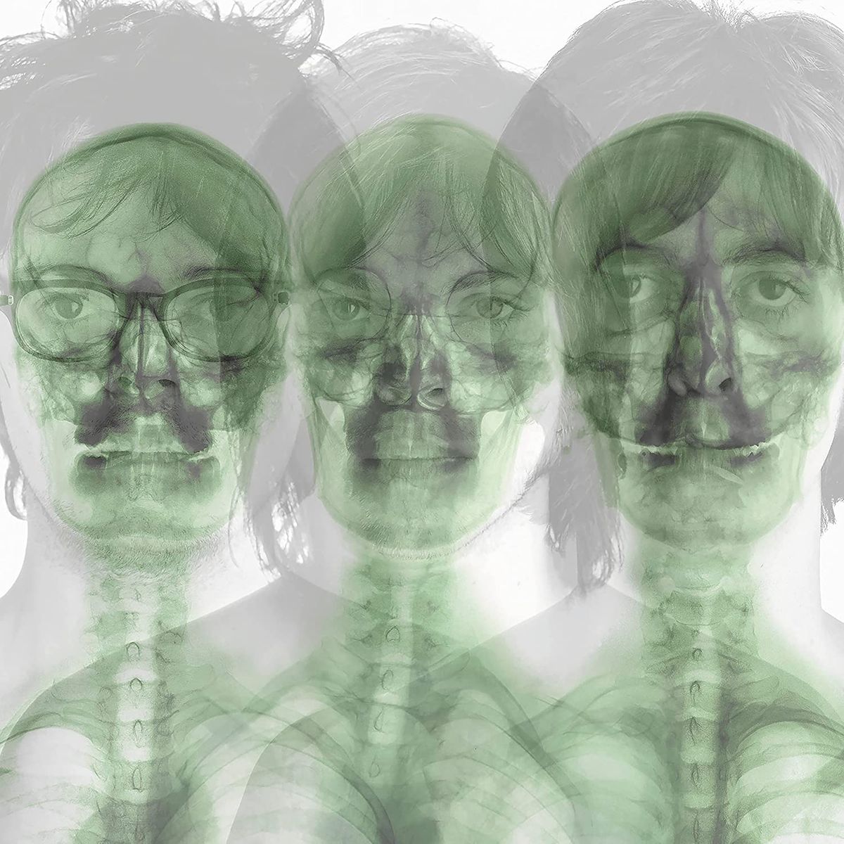 Supergrass [Deluxe Edition] (CD)
